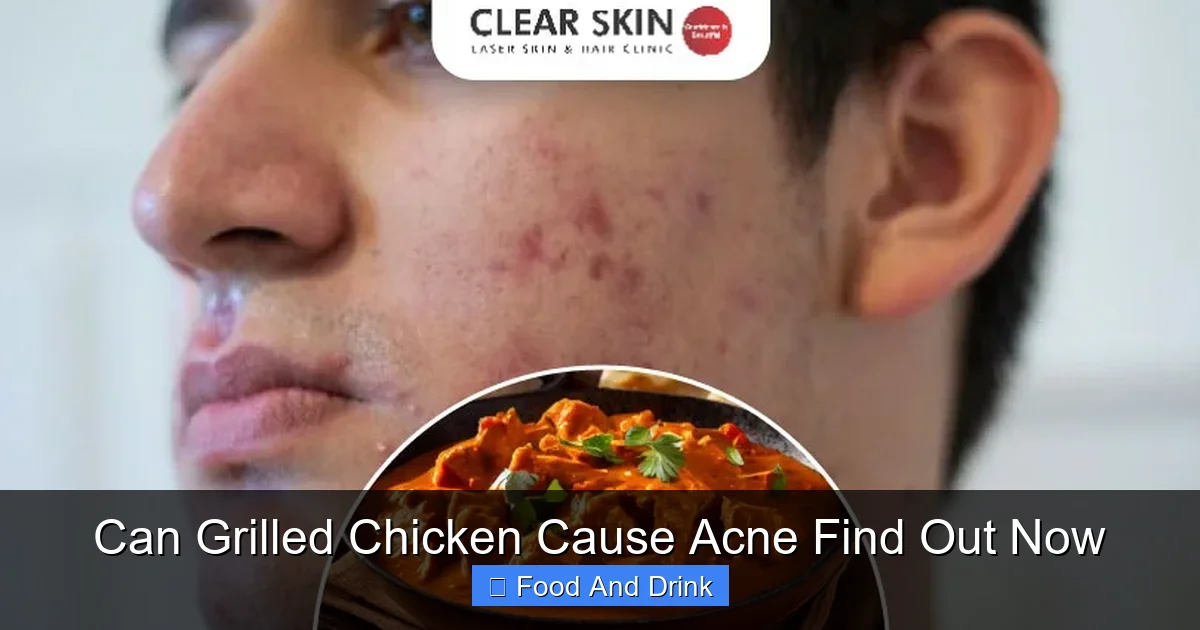 Can Grilled Chicken Cause Acne Find Out Now